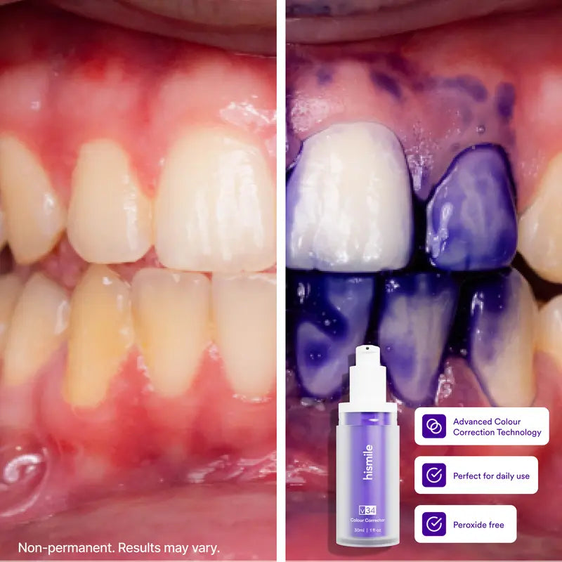 [NEW] [Hismile] V34 Colour Corrector Serum Value Set, Tooth Stain Concealer, Temporary Brightening Booster, Purple Toothpaste, Colour Correcting