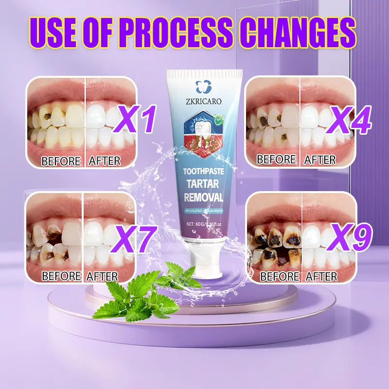 Clinical Strength Fluoride Blend Cavity Guard Toothpaste - Gentle Menthol Mint Cleansing, Cellulose Gum Enamel Repair, Anti-Decay, Plaque-Fighting, 12H Fresh Breath, Sorbitol Deep Clean, Teeth Whitening, Healthy Gums, Coffee Sensitivity Care