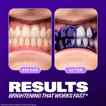 [NEW] [Hismile] V34 Colour Corrector Serum Value Set, Tooth Stain Concealer, Temporary Brightening Booster, Purple Toothpaste, Colour Correcting