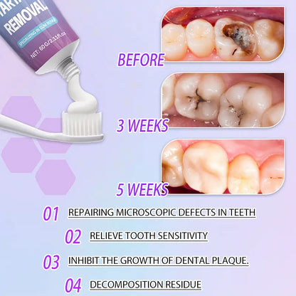 Clinical Strength Fluoride Blend Cavity Guard Toothpaste - Gentle Menthol Mint Cleansing, Cellulose Gum Enamel Repair, Anti-Decay, Plaque-Fighting, 12H Fresh Breath, Sorbitol Deep Clean, Teeth Whitening, Healthy Gums, Coffee Sensitivity Care